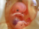 11. h�t